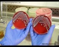 hands with gloves holding Petri dishes with klebsiella pneumoniae bacteria on blood agar